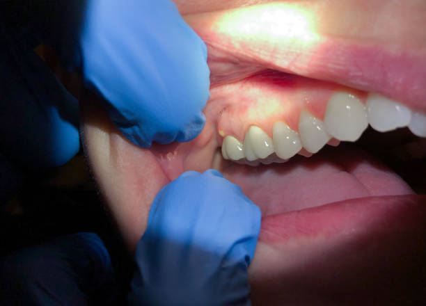 Professional Emergency Dental Service in LA