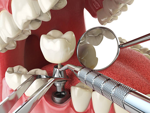 Best Weekend Emergency Dental Services in Ville Ptte, LA